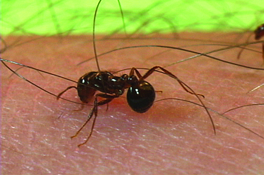 Ant On An Arm   Ant On An Arm 